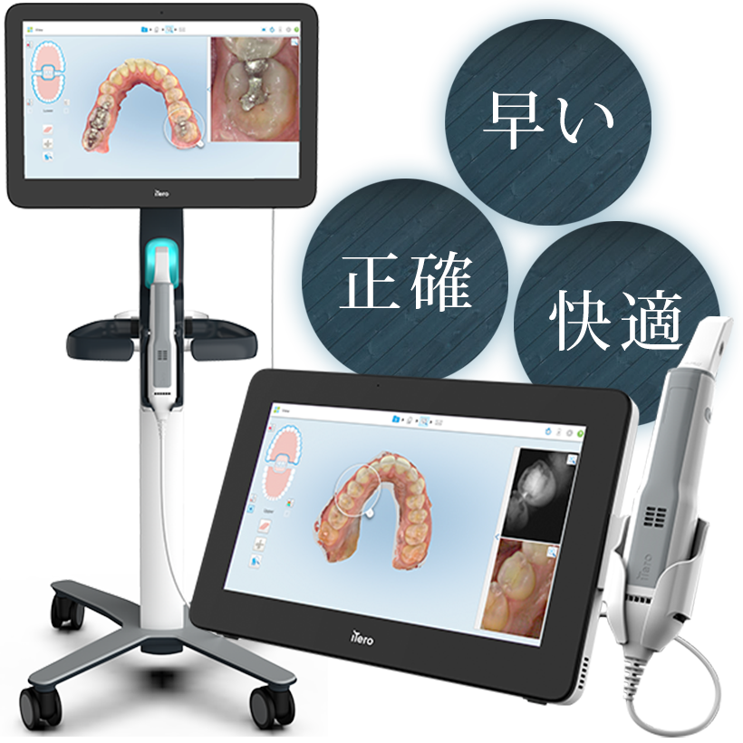 インビザライン専用口腔内スキャナーiTero(アイテロ)