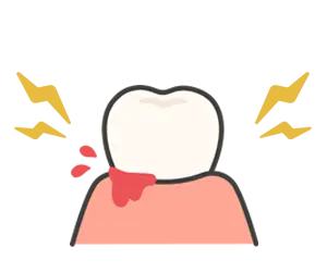 虫歯、歯周病の予防にも繋がる